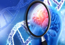 alzheimer fasci di luce intermittente