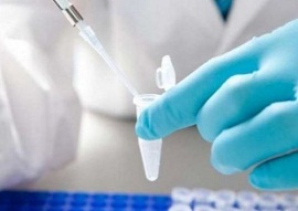 Biopsia liquida tumore prelievo