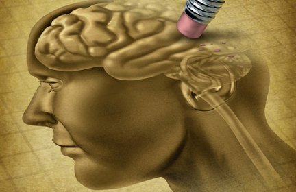 brutti ricordi cervello