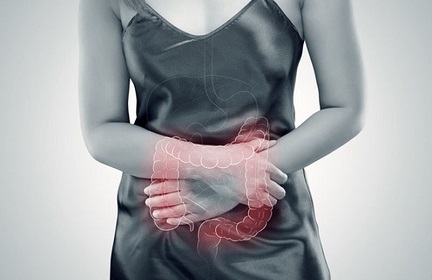Sindrome del colon irritabile